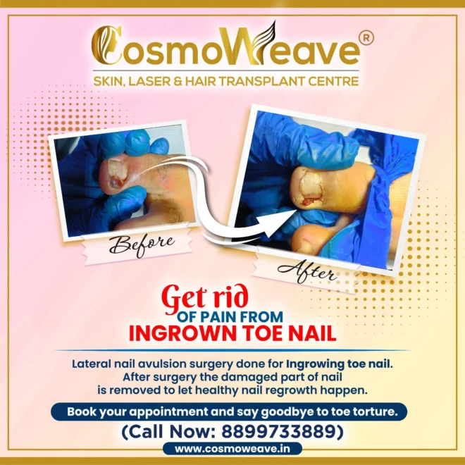Treatment result before and after treatment result at Cosmoweave Jammu