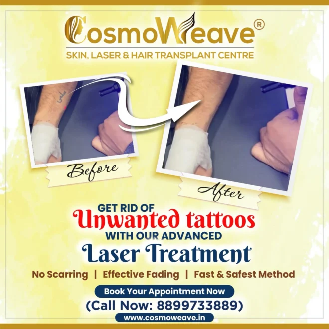 Treatment result before and after treatment result at Cosmoweave Jammu