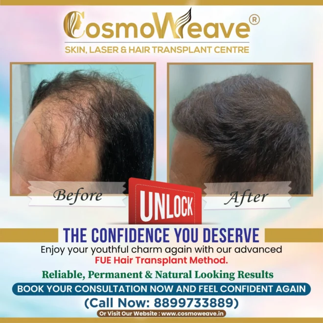 Treatment result before and after treatment result at Cosmoweave Jammu