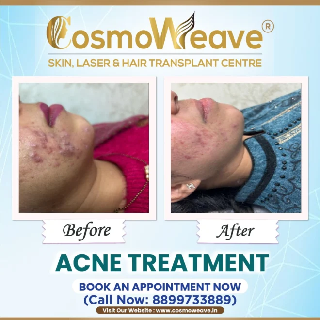 Treatment result before and after treatment result at Cosmoweave Jammu