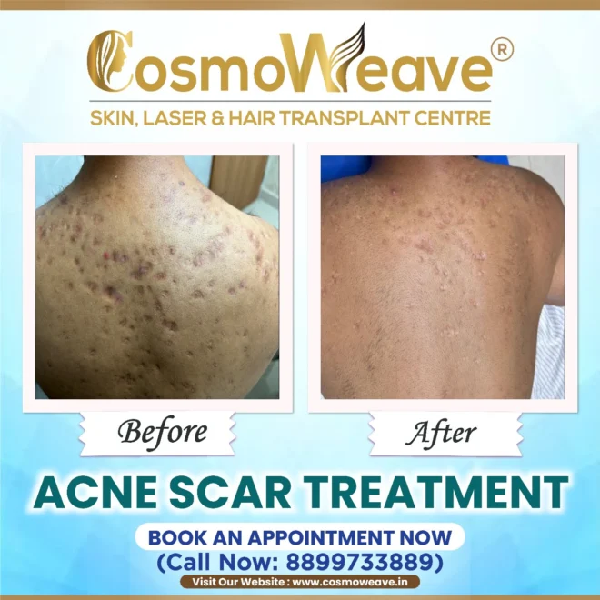 Treatment result before and after treatment result at Cosmoweave Jammu