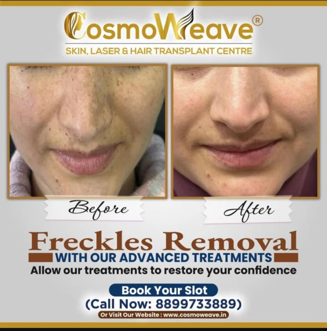 Treatment result before and after treatment result at Cosmoweave Jammu