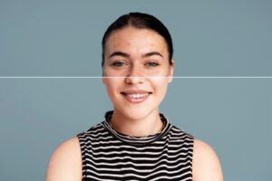 Read more about the article Skin Pigmentation: Dark Marks, Melasma and Changes in Colour