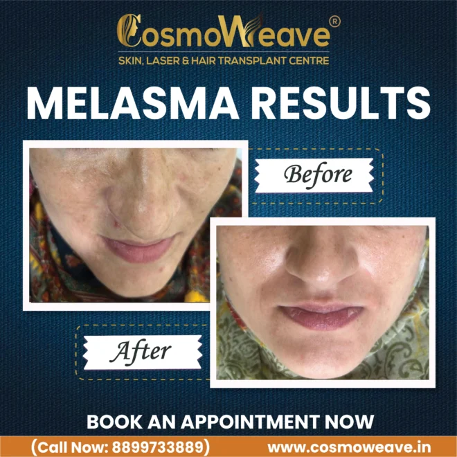 Treatment result before and after treatment result at Cosmoweave Jammu