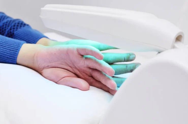 Narrow band UVB Light Therapy 16