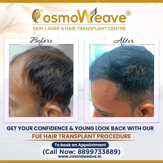 Treatment result before and after treatment result at Cosmoweave Jammu
