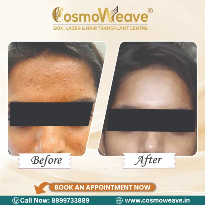 Treatment result before and after treatment result at Cosmoweave Jammu